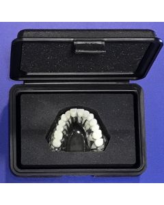 ID-290523 - ***Only Britni Bruins and Dawn Heilman Can Order*** DSO Kit Crown & Bridge Implant Model